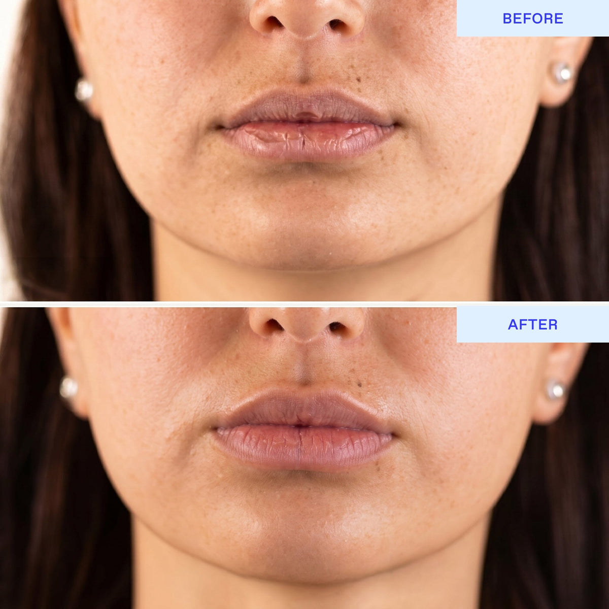 BioRepublic Lip Mask Lip Mask BioRepublic 