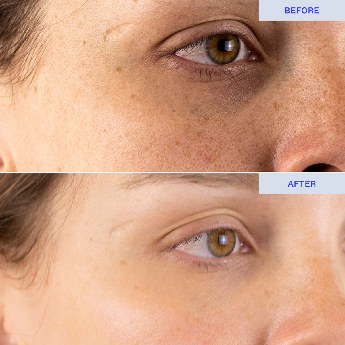 Lost Baggage Under Eye Emergency Repair Mask Eye Mask BioRepublic 